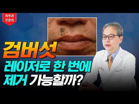 검버섯 레이저로 한 번에 제거 가능할까❓ 검버섯 없애는 방법