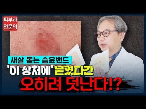 습윤밴드 올바른 사용법 & 교체 시기 정확하게 알려드립니다! [듀오덤, 메디폼, 상처치료, 대일밴드]