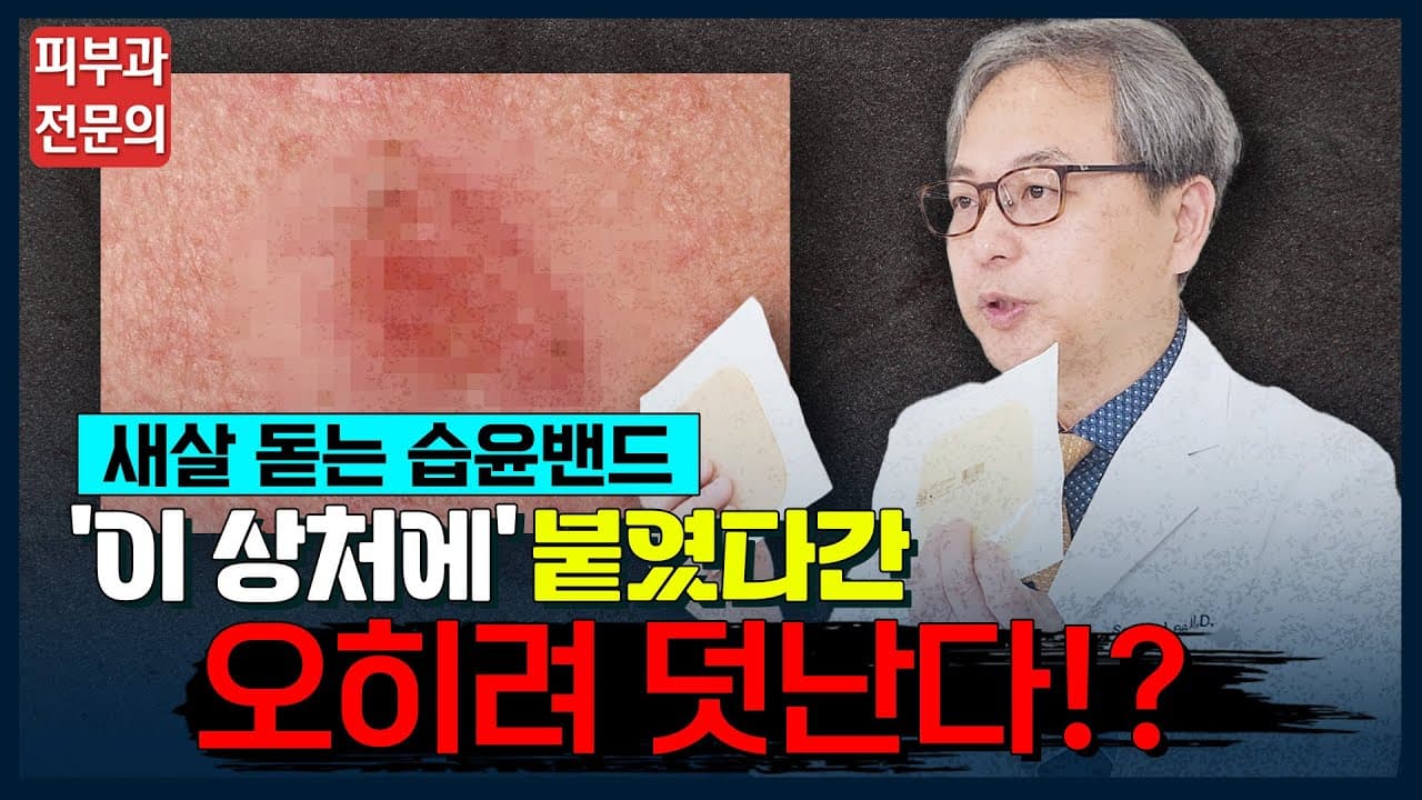 습윤밴드 올바른 사용법 & 교체 시기 정확하게 알려드립니다! [듀오덤, 메디폼, 상처치료, 대일밴드]