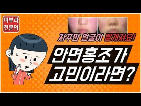안면홍조라면? 꼭 봐야할 영상(원인, 치료, 관리법까지)