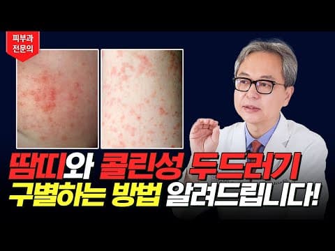 Heat Rash Vs Cholinergic Urticaria: How To Tell Them Apart, Causes To Solutions