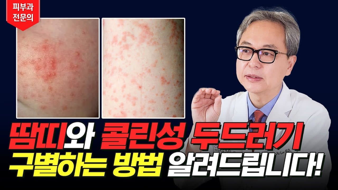 あせもとコリン性蕁麻疹を見分ける方法！原因から解決方法まで！