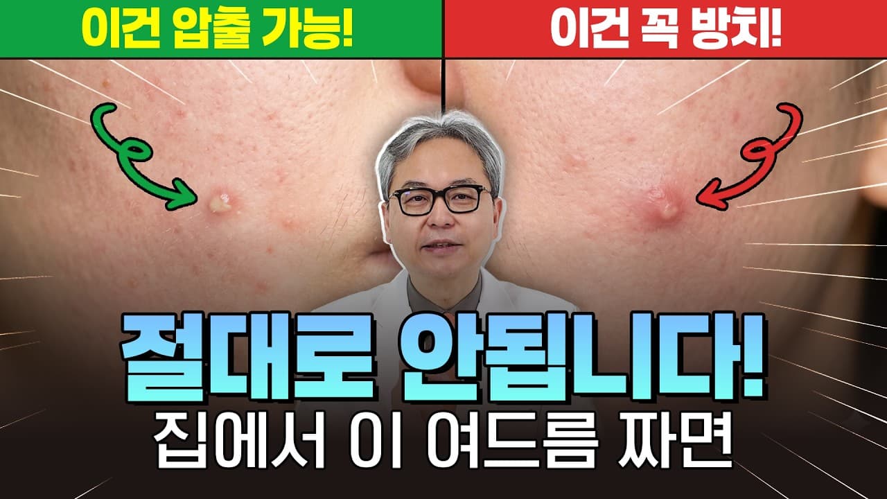 짜면 무조건 망합니다! 피부과 전문의가 절대 손대지 말라는 여드름 3가지