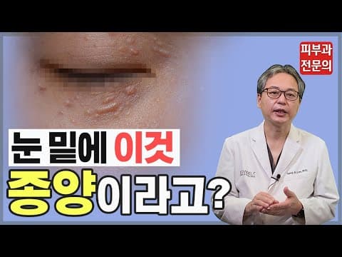 이게 종양이라고??? 치료법 알려드립니다(한관종, 눈밑한관종)