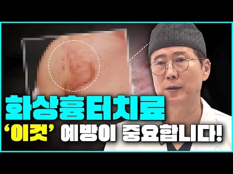 [화상흉터] 초기화상흉터 VS 오래된화상흉터 치료법은 어떻게 다를까요?