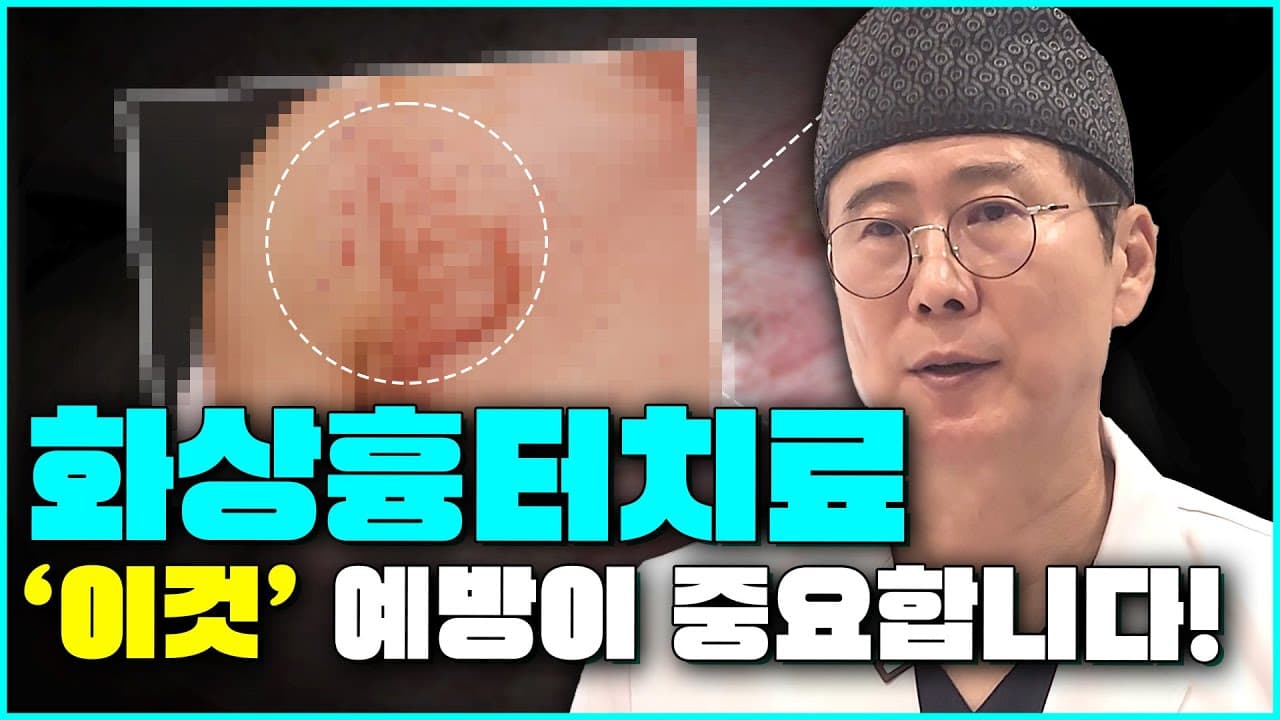 Early vs Old Burn Scars: How Do Their Treatments Differ?