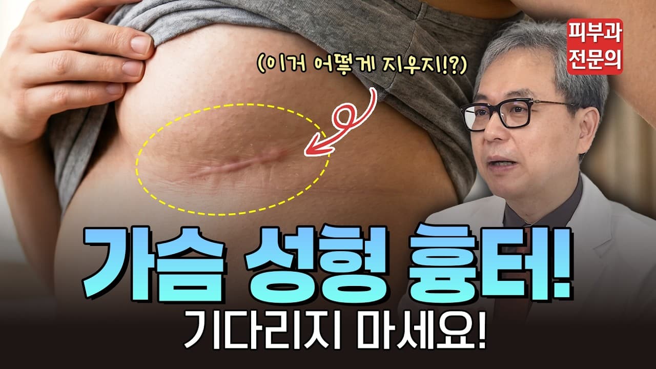 성형 후 흉터 생길까 봐 6개월 동안 무작정 기다리면 후회하는 이유 (전문의 팩트체크)