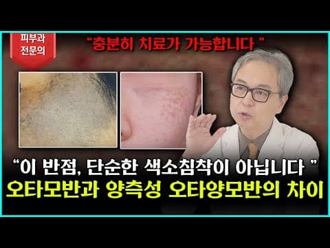 오타모반이라고 들어보셨나요? 그것과 헷갈릴 수있는 양측성 오타양모반! 오늘 정확히 알려드립니다