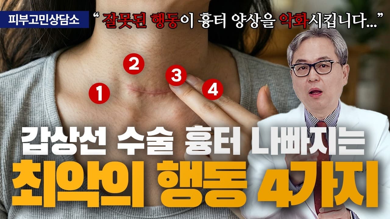 갑상선 수술 흉터, 제가 진료실에서 자주 보는 오해들 | 신촌 연세스타피부과