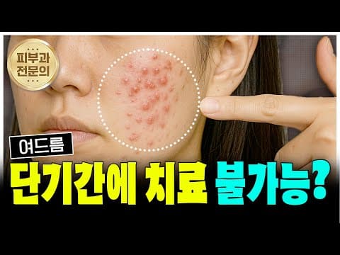 여드름 단기간에 없앤다? 절대 속지 마세요 (피부과 전문의도 경고한 현실)