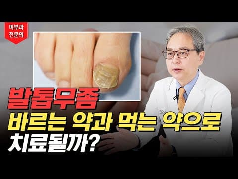 爪水虫、飲み薬or塗り薬でどれくらい治る？