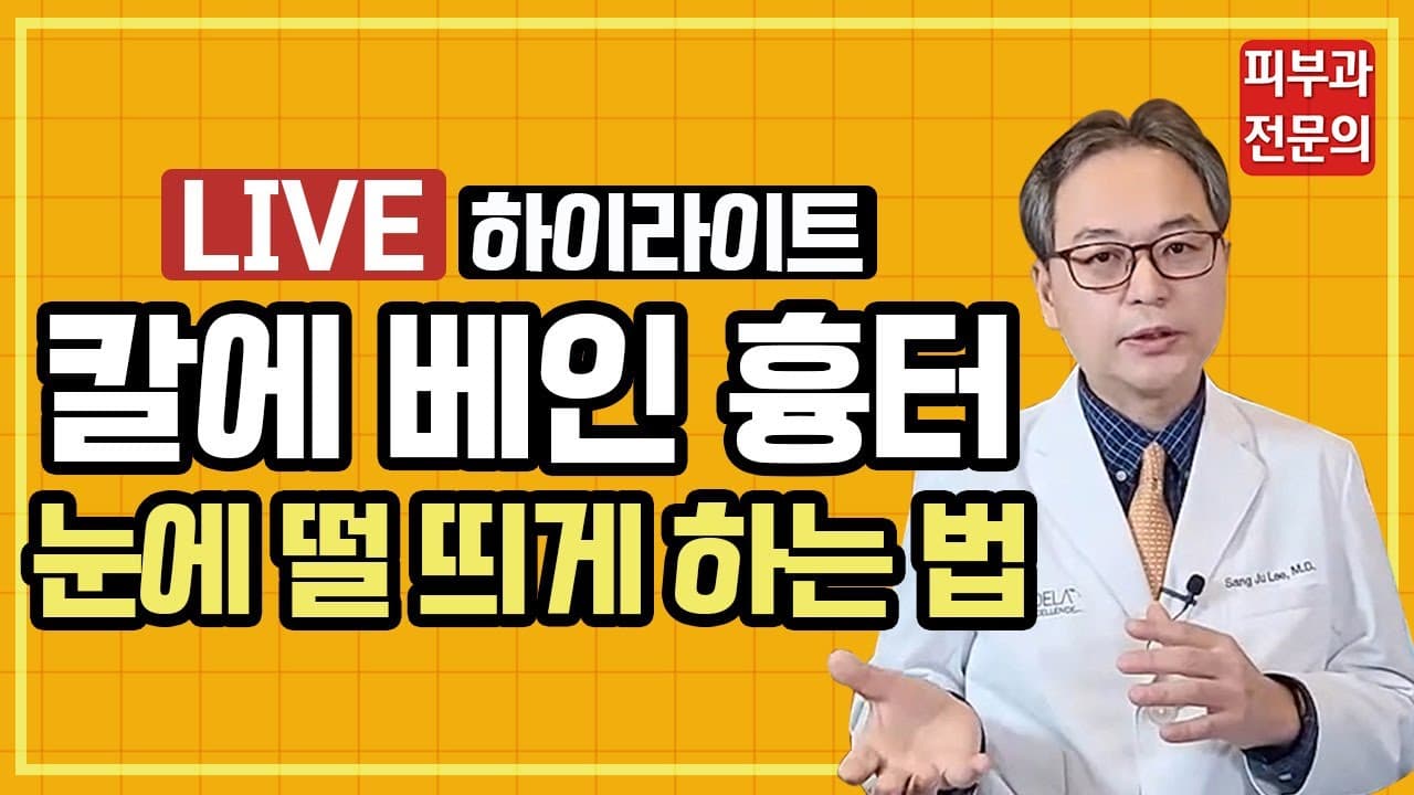칼에 베인 흉터 최대한 눈에 덜 띄게 하는 방법?! (자해흉터없애는법)