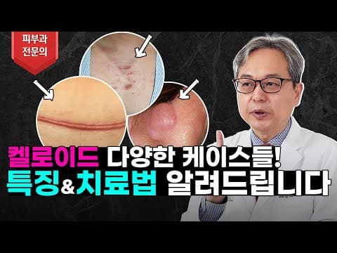 瘢痕疙瘩的各种案例！为您讲解各自的特征和对应的治疗方法！