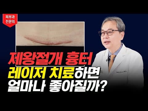 彻底去除剖腹产疤痕的方法，皮肤科专科医生为您讲解