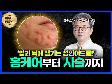 입·턱 여드름, 집에서 관리부터 피부과 시술까지 총정리!