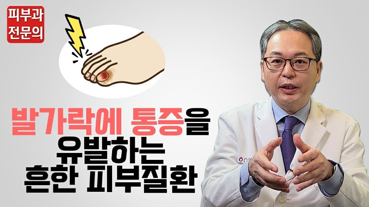 발가락에 통증을 유발하는 흔한 피부질환