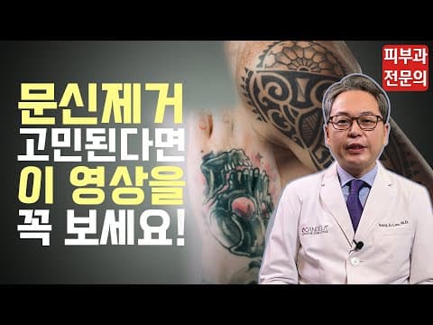 タトゥー除去を悩んでいるなら必見！（カラータトゥー＆白黒タトゥー）