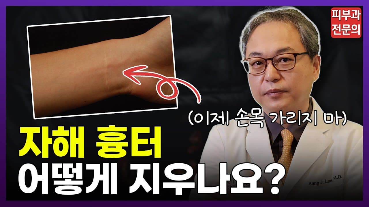 자해흉터 없애는 법, 연고로 치료 되나요? | 커버업 타투, 레이저