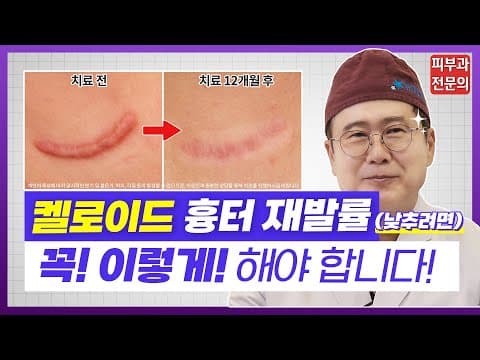 ケロイド瘢痕が再発しないように治療する方法｜皮膚科専門医がはっきり解説