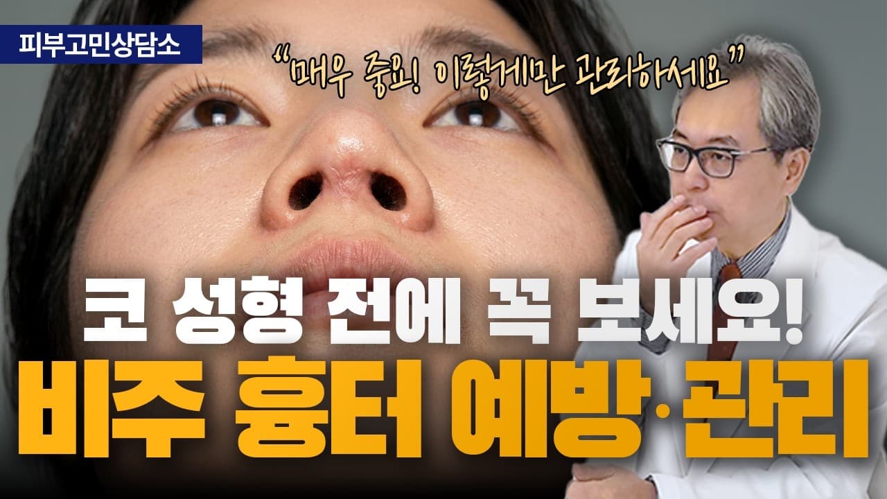 코성형 흉터, 골든타임을 놓치면 구축까지 생길 수 있습니다 | 신촌 연세스타피부과