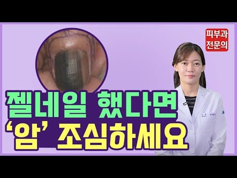 ネイルアート・ペディキュア・ジェルネイルシールをしたらこの疾患に注意！（爪の黒い線、足爪の黒い線）