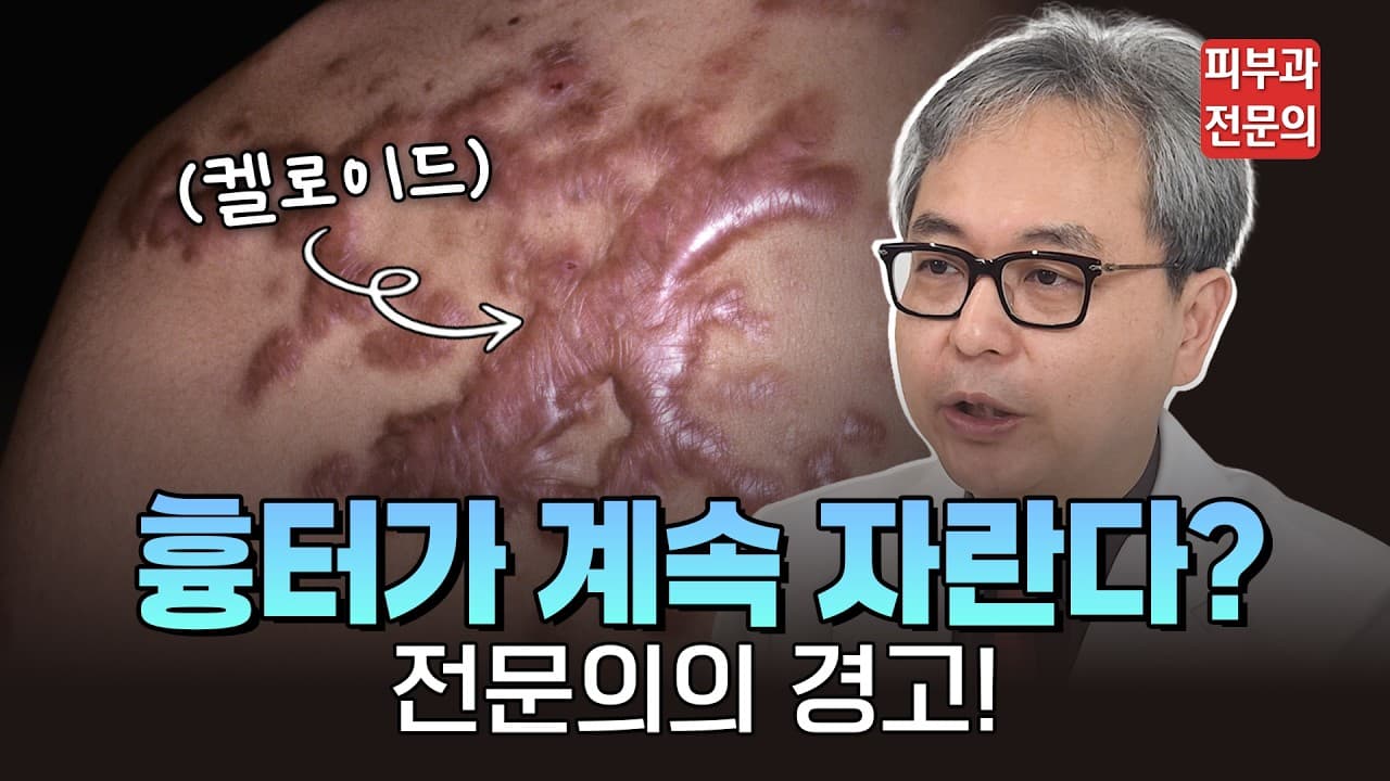 Wound Healed but Keeps Swelling Early Scar Treatment Saves Time