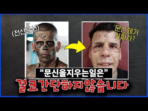 문신을 지우는일은 결코 간단한 것이 아닙니다.