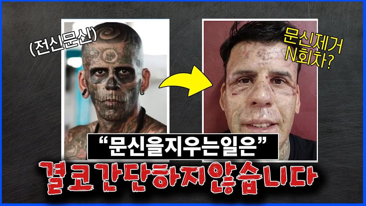 문신을 지우는일은 결코 간단한 것이 아닙니다.