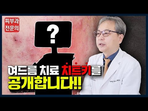 让痘痘治疗效果翻倍的反转施术公开