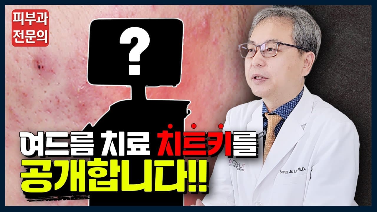 ニキビ治療の効果を倍にする意外な施術を公開