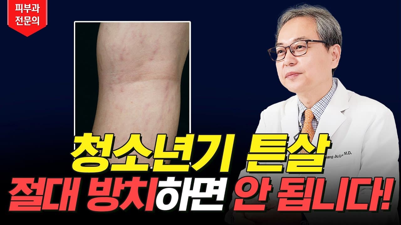청소년 튼살 지금 바로 치료해야 하는 이유 ☝🏻 튼살 크림 레이저 추천