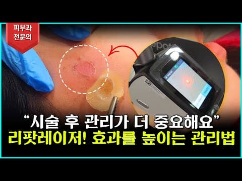 리팟레이저 시술만 받고 끝? 진짜 효과는 ‘이것’에 달렸어요!