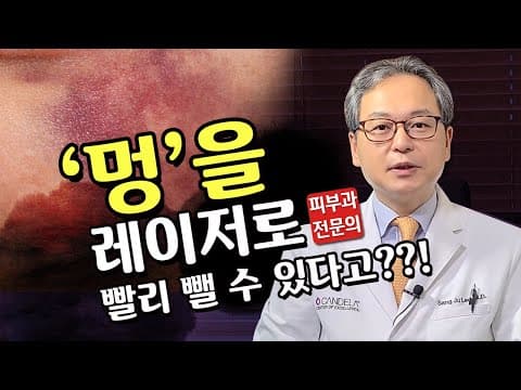 멍의 원인과 치료방법