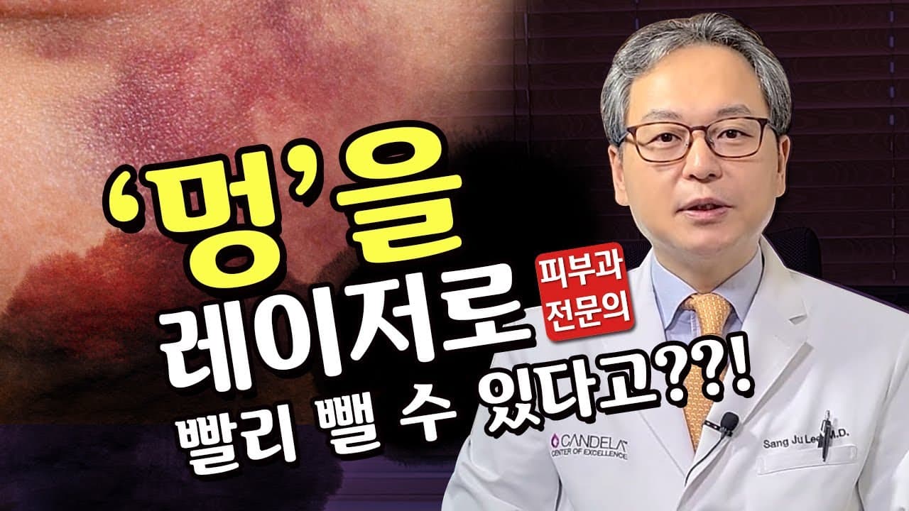 멍의 원인과 치료방법