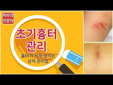 흉터를 적게 남기는 상처 관리법(초기 붉은 흉터관리)