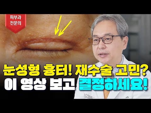 目頭切開や二重など目整形の傷跡、レーザー除去vs再手術、迷ったら必見！