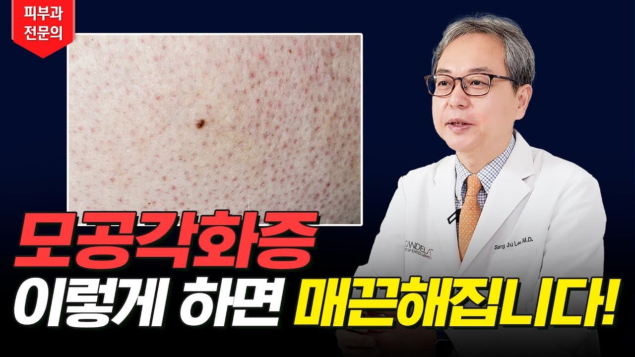 Keratosis Pilaris: How To Smooth Away Chicken Skin Bumps
