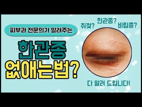 한관종 원인과 제거방법 공개 (feat. 비립종,편평사마귀,쥐젖)