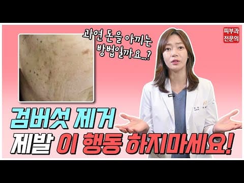 검버섯 레이저로 1~2회 만에 확실하게 없애는 방법