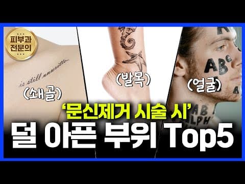문신제거 시술 시 가장 덜 아픈부위가 있다!? 문신제거 후 홈케어 방법까지!