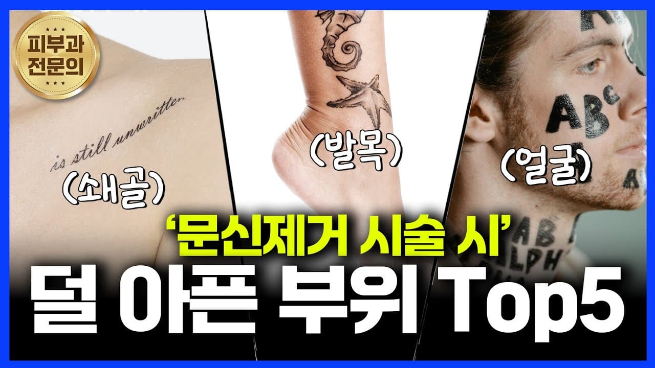 문신제거 시술 시 가장 덜 아픈부위가 있다!? 문신제거 후 홈케어 방법까지!