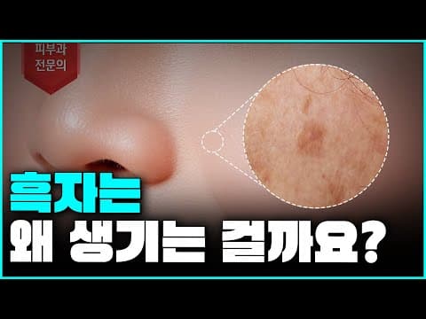 [흑자] 거울 볼 때마다 스트레스받게하는 흑자는 대체 왜 생기는 걸까?