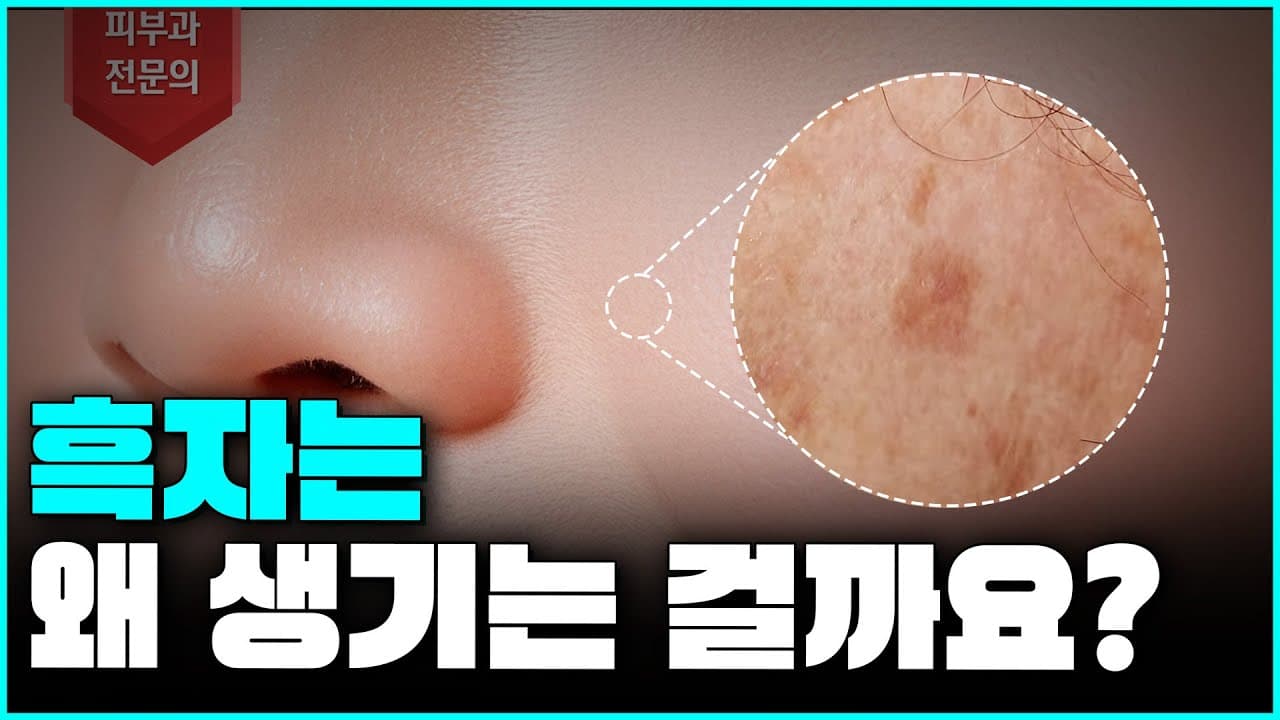鏡を見るたびストレスになる黒子は一体なぜできる？