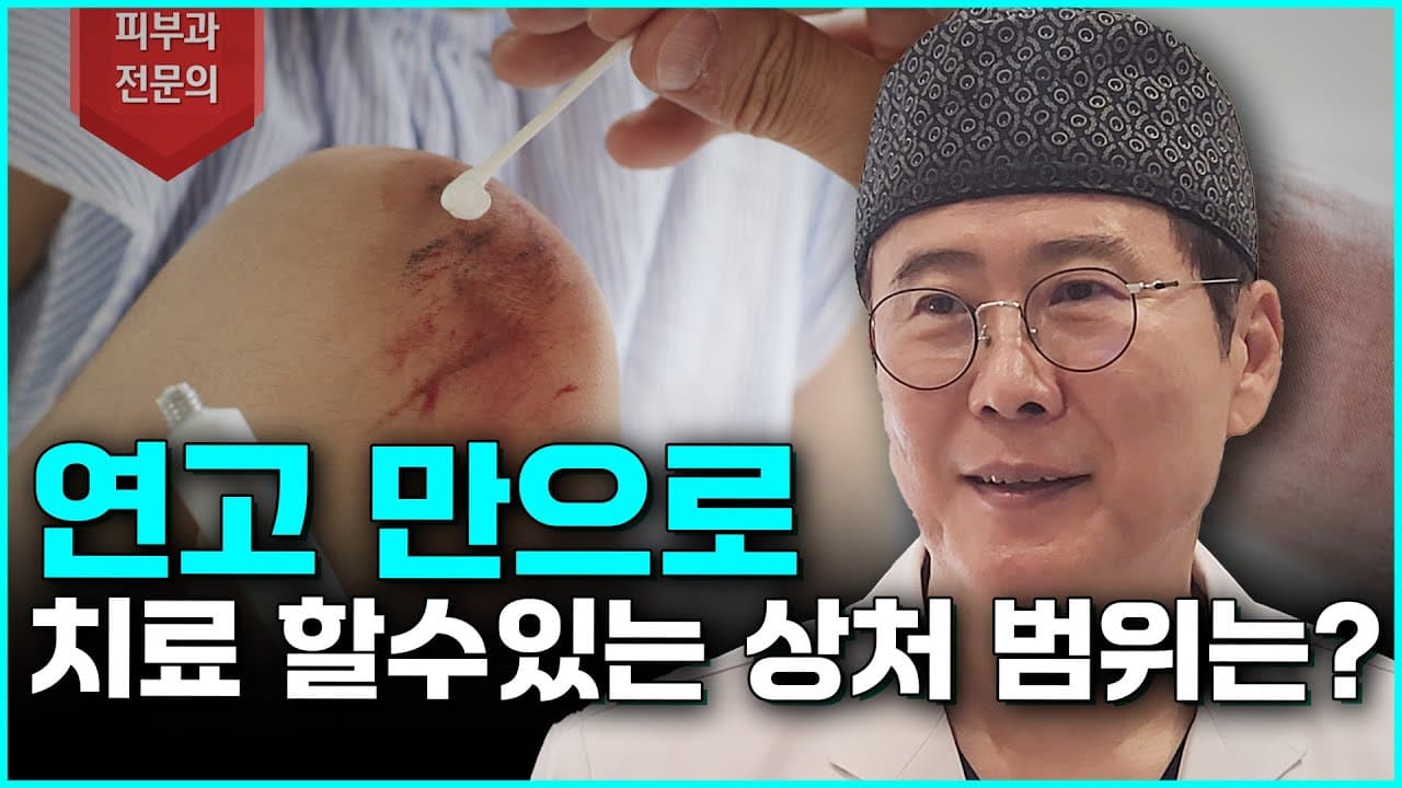 [상처관리, 상처치료] 연고만으로 치료 할 수 있는 상처범위는?