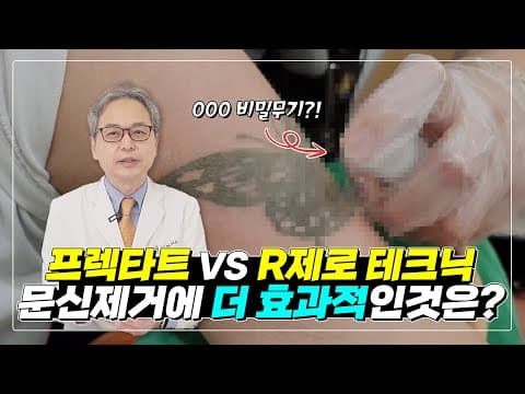 タトゥーを後悔したら？タトゥー除去、フラクタートVS Rゼロ、どちらが効果的？｜早いタトゥー除去｜レーザータトゥー除去