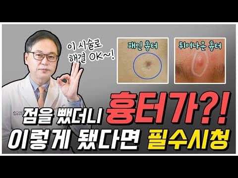 점뺀흉터 걱정된다면 꼭 보세요! | 점뺀 후 흉터 관리 치료