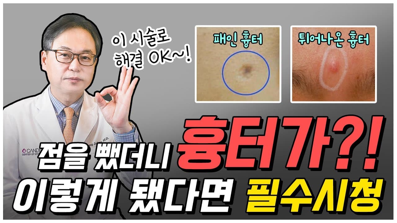 점뺀흉터 걱정된다면 꼭 보세요! | 점뺀 후 흉터 관리 치료