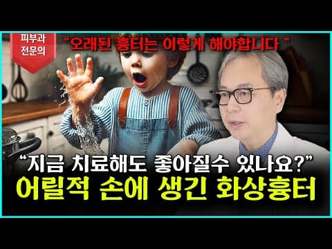 [화상흉터] 너무 늦은건 아닐까요? 어릴적 생긴 흉터도 치료가 가능할까?