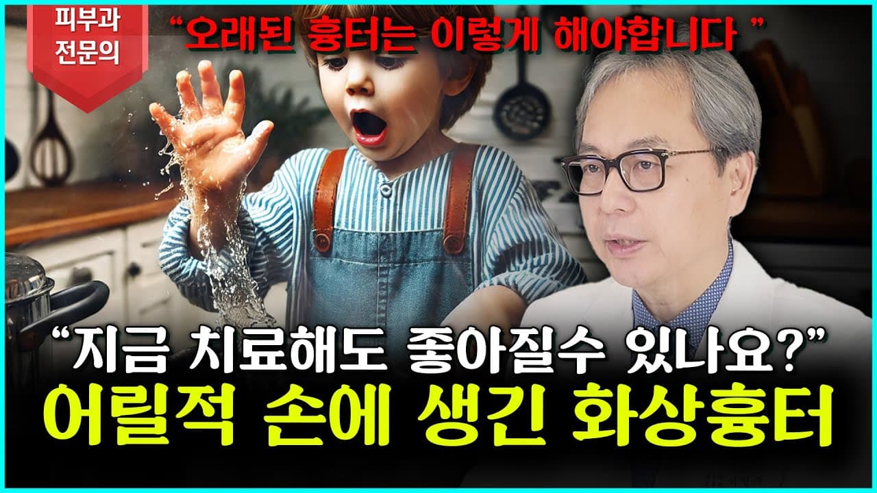 [화상흉터] 너무 늦은건 아닐까요? 어릴적 생긴 흉터도 치료가 가능할까?