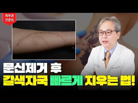 문신제거 갈색 자국 색소침착 🟤 빠르게 지우는 꿀팁 공개🍯 문신 깔끔하게 지우는 방법